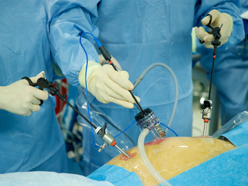 Surgeon's Hands with Laparoscopic Instruments